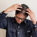 薄毛・脱毛・AGA・FAGA